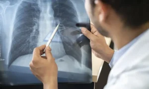 Cigarro avança entre adolescentes e jovens adultos brasileiros, alerta estudo