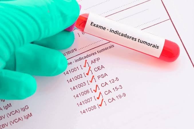 Teste de Sangue Avançado que Identifica 50+ Cânceres Chega ao Brasil